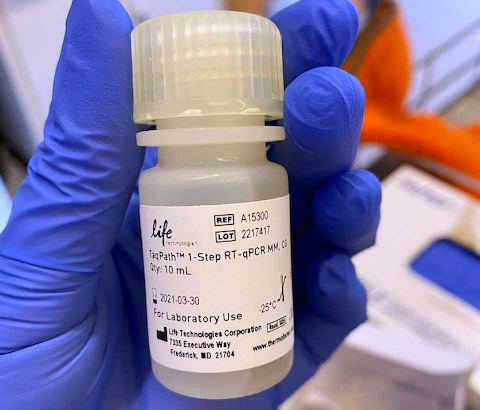 Testing for the novel coronavirus requires a series of reactions to find the virus's genetic material from a tissue sample