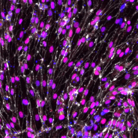 Endothelial cell markers. Photo Credit: COURTESY PHOTO