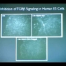 Embedded thumbnail for Embryonic Stem Cell Research: A Scientific Overview
